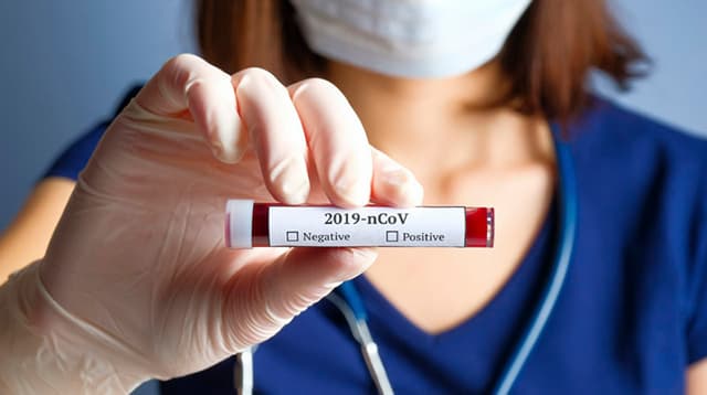 О не исчислении взносов ОГСС и ОМС из расходов работодателя для тестирования работников на наличие СОVID19